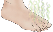 Vos pieds transpire et...
